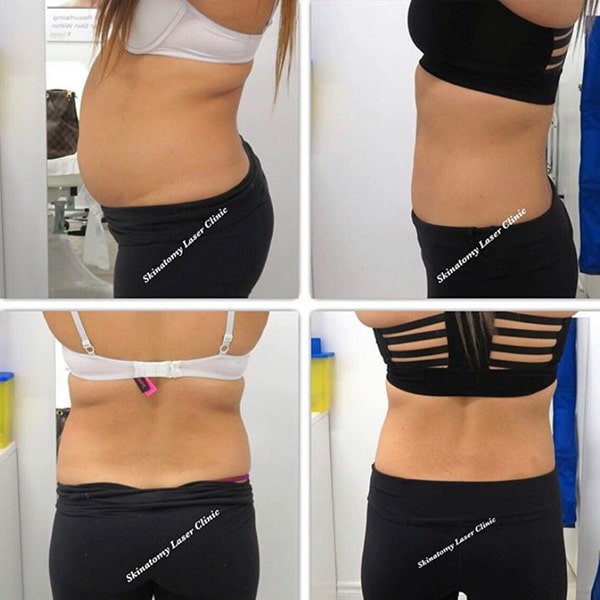 Fat Burning Injections Near Me Fat Burning Injections Near Me