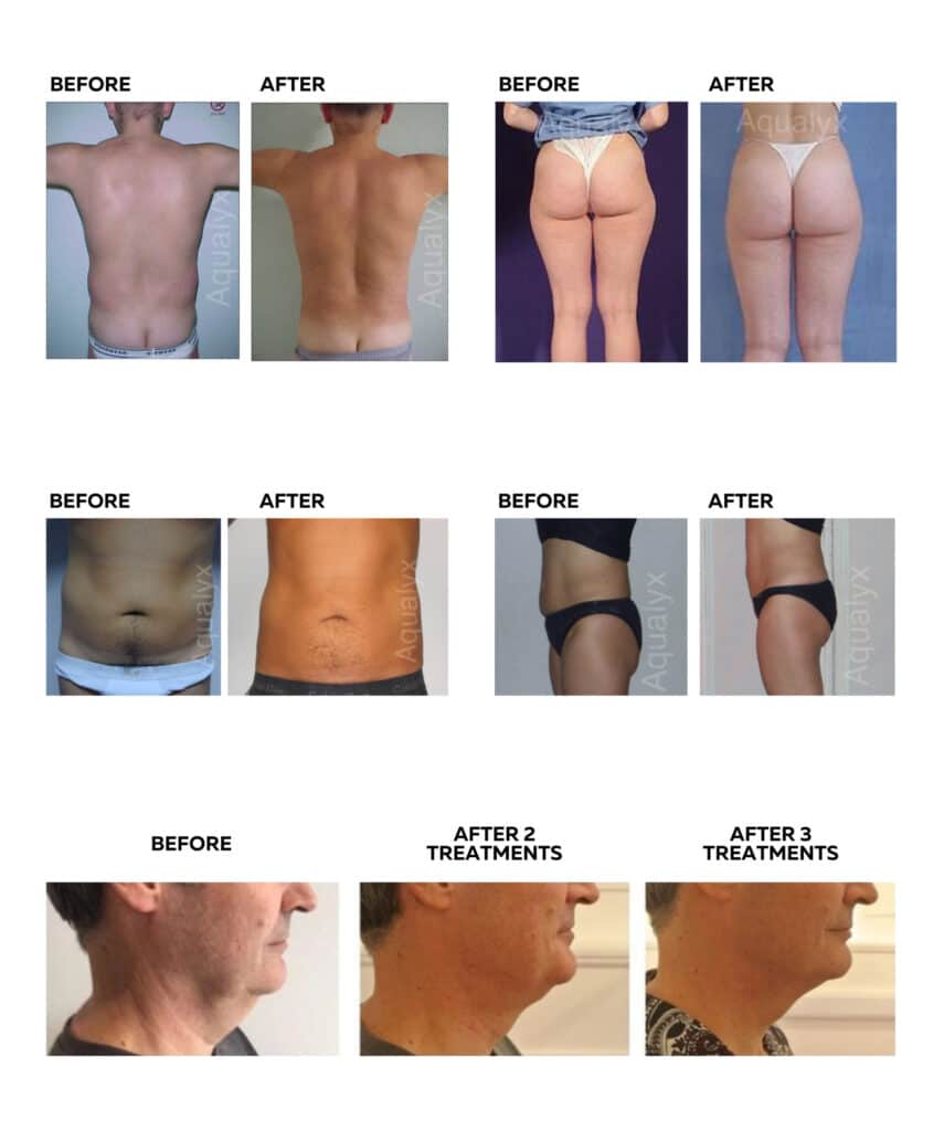 Fat Burning Injections Near Me Fat Burning Injections Near Me