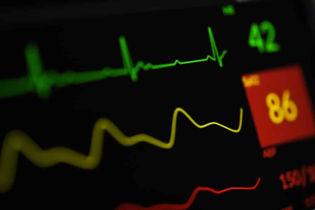 Photo Heart rate monitor