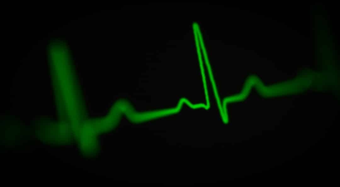 Photo Heart rate monitor
