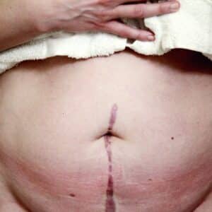 Photo Belly Fat Burner Belt