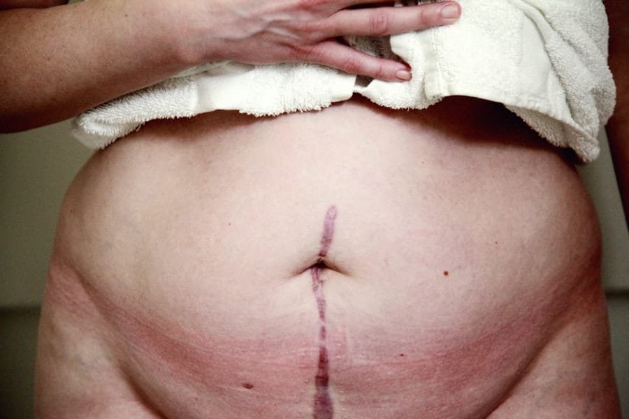 Belly Fat Burner Belt